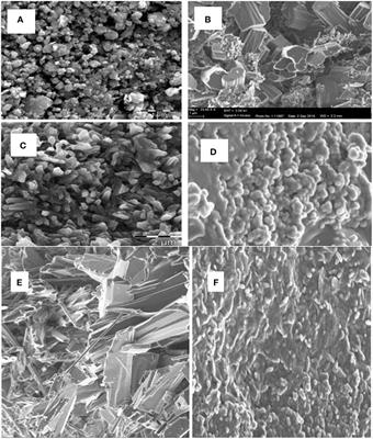 Development of Electrochemical Nanosensor for the Detection of Malaria Parasite in Clinical Samples